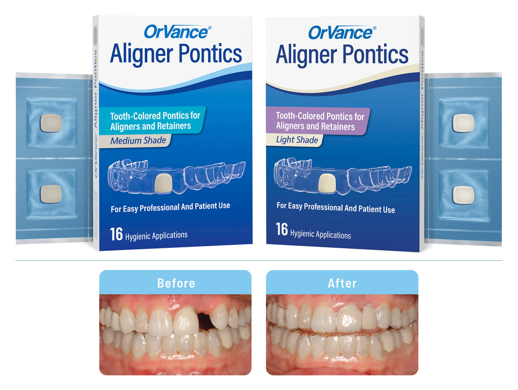 OrVance® Aligner Pontics