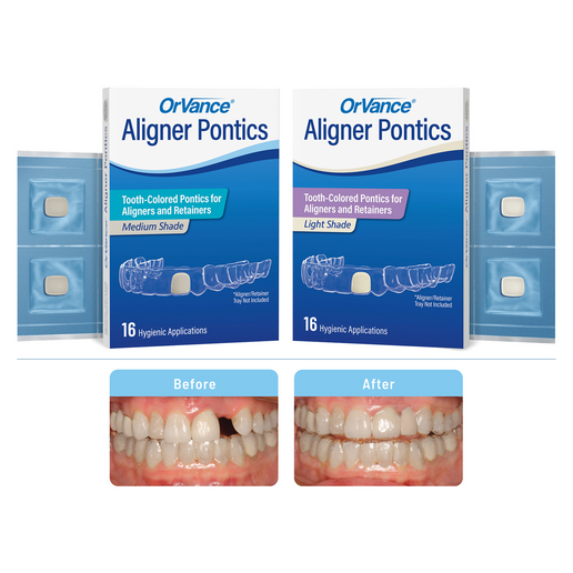 OrVance® Aligner Pontics
