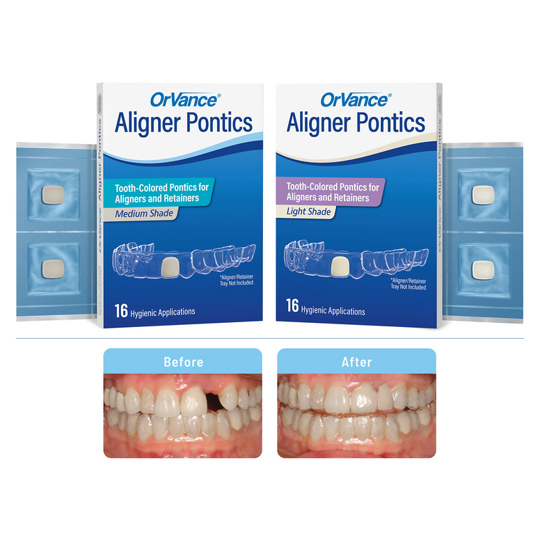 OrVance® Aligner Pontics