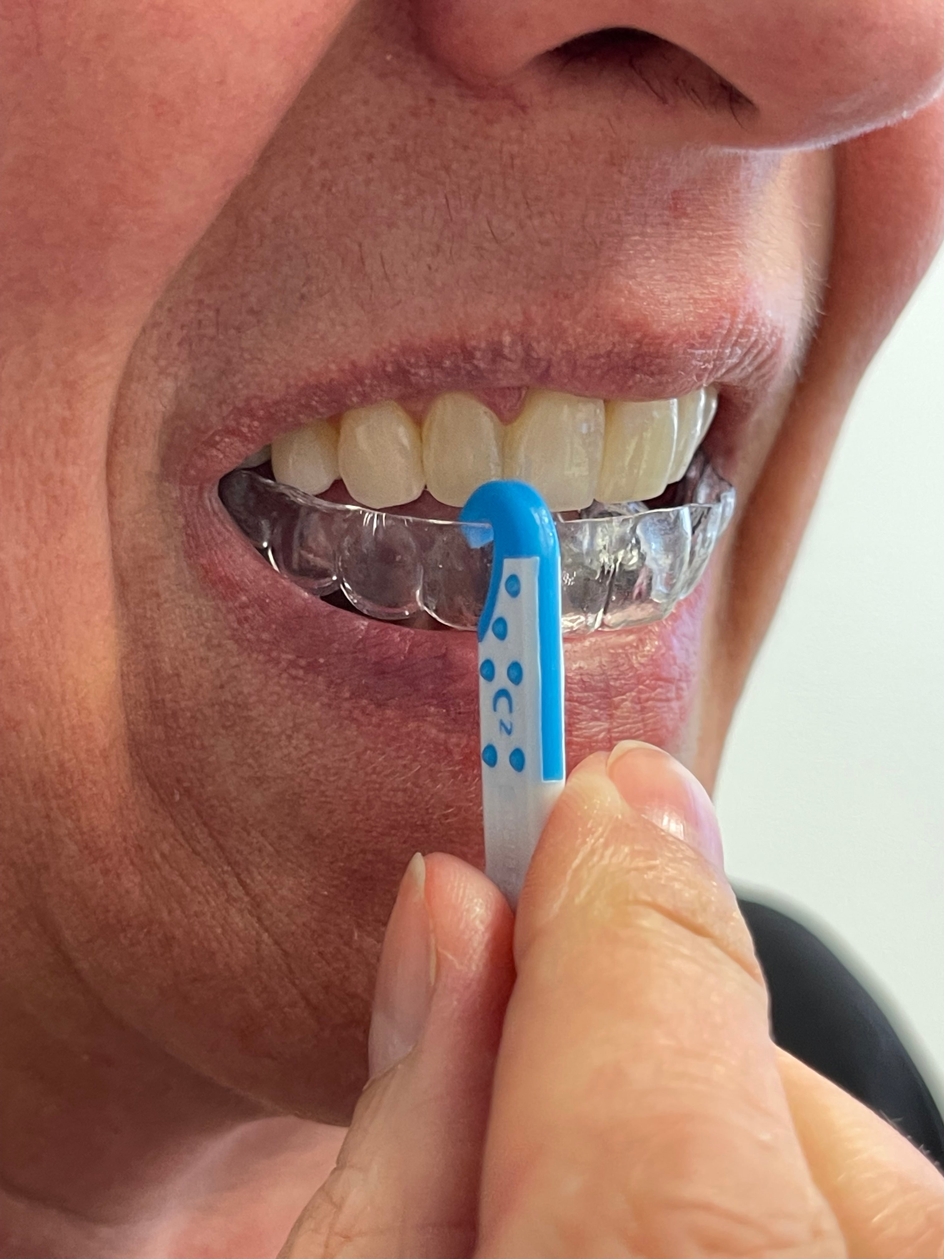 OrVance Aligner Pontics - 16 Count