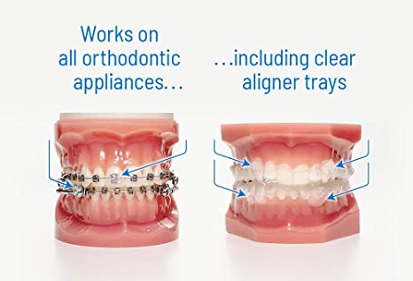orthodots clear aligner trays braces